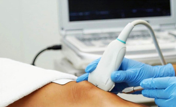 Echograie Fysiotherapie